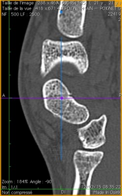 scanner profil scaph